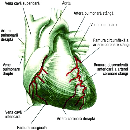 imagini infarctul miocardic acut